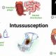 Infant Sleep: Can a Baby Sleep With Intussusception? &amp; Tips | Baby Care 101: Essential Tips for Happy, Healthy Babies