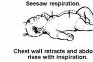Baby's Breath: The Power of Belly Breathing for Infants Safem Fabrication - Precision Engineering & Custom Manufacturing Solutions Baby's Breath: The Power of Belly Breathing for Infants | Safem Fabrication - Precision Engineering & Custom Manufacturing Solutions
