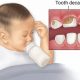 Best Baby Bottle Tooth Decay Treatment Guide &amp; Tips | Baby Care 101: Essential Tips for Happy, Healthy Babies