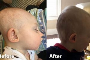 Baby Helmet: Before & After Symmetry For Your Little One! Baby Care 101: Essential Tips for Happy, Healthy Babies Baby Helmet: Before & After Symmetry For Your Little One! | Baby Care 101: Essential Tips for Happy, Healthy Babies