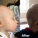 Baby Helmet: Before & After Symmetry For Your Little One! | Baby Care 101: Essential Tips for Happy, Healthy Babies