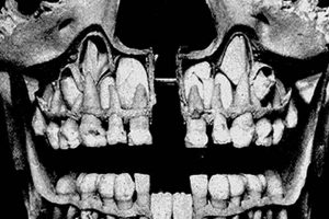 Baby Skull Teeth: Guide to Infant Dental Development Baby Care 101: Essential Tips for Happy, Healthy Babies Baby Skull Teeth: Guide to Infant Dental Development | Baby Care 101: Essential Tips for Happy, Healthy Babies