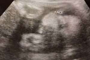 Is Your Baby Measuring a Week Ahead? Concerns & Tips Baby Care 101: Essential Tips for Happy, Healthy Babies Is Your Baby Measuring a Week Ahead? Concerns & Tips | Baby Care 101: Essential Tips for Happy, Healthy Babies