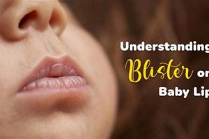 Help! Baby's Lip Blister From Breastfeeding: Causes & Care Baby Care 101: Essential Tips for Happy, Healthy Babies Help! Baby's Lip Blister From Breastfeeding: Causes & Care | Baby Care 101: Essential Tips for Happy, Healthy Babies