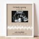 Cherished Baby Heartbeat Ultrasound Gift: A Keepsake! | Baby Care 101: Essential Tips for Happy, Healthy Babies