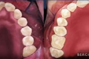 High Palate Baby: Causes & Care Tips for Babies Baby Care 101: Essential Tips for Happy, Healthy Babies High Palate Baby: Causes & Care Tips for Babies | Baby Care 101: Essential Tips for Happy, Healthy Babies