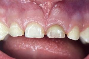 Baby Goat Teeth Trauma: Treatment & Care Tips Baby Care 101: Essential Tips for Happy, Healthy Babies Baby Goat Teeth Trauma: Treatment & Care Tips | Baby Care 101: Essential Tips for Happy, Healthy Babies
