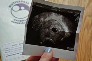 Baby at 10 Weeks: Your "baby 10. Woche" Guide! Baby Care 101: Essential Tips for Happy, Healthy Babies Baby at 10 Weeks: Your "baby 10. Woche" Guide! | Baby Care 101: Essential Tips for Happy, Healthy Babies