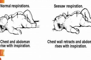 Baby's Seesaw Breath: Causes, Signs & When to Worry Baby Care 101: Essential Tips for Happy, Healthy Babies Baby's Seesaw Breath: Causes, Signs & When to Worry | Baby Care 101: Essential Tips for Happy, Healthy Babies