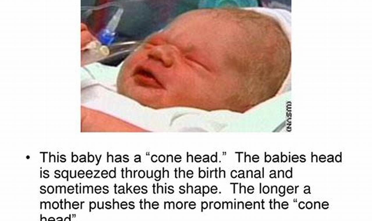 Tiny Baby Cone: Growth & Care Tips for Conifers Baby Care 101: Essential Tips for Happy, Healthy Babies Tiny Baby Cone: Growth & Care Tips for Conifers | Baby Care 101: Essential Tips for Happy, Healthy Babies