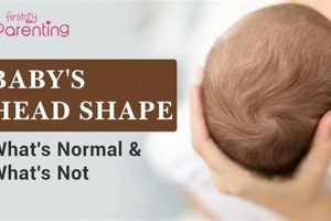 Baby's Head Shape: Guide to Healthy Development Tips | Baby Care 101: Essential Tips for Happy, Healthy Babies