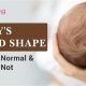 Baby's Head Shape: Guide to Healthy Development Tips | Baby Care 101: Essential Tips for Happy, Healthy Babies
