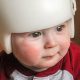 Baby Helmet for Flat Head Cost: What's the Price? Guide | Baby Care 101: Essential Tips for Happy, Healthy Babies