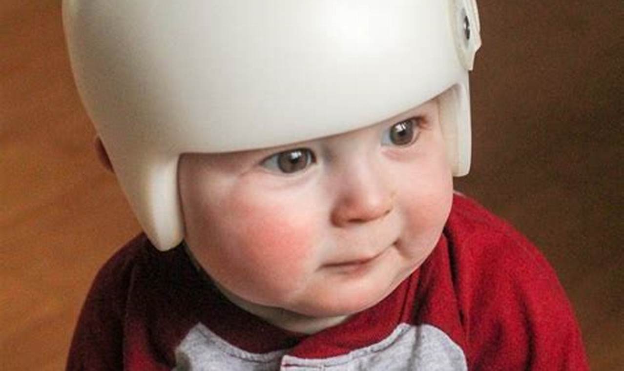 Baby Helmet for Flat Head Cost: What's the Price? Guide | Baby Care 101: Essential Tips for Happy, Healthy Babies