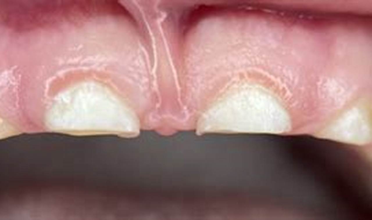 Stop Baby Teeth Grinding: Causes & Solutions for Babies | Baby Care 101: Essential Tips for Happy, Healthy Babies