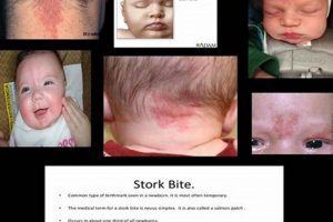 Early MTHFR Signs: Gene Mutation Clues in Babies | Baby Care 101: Essential Tips for Happy, Healthy Babies