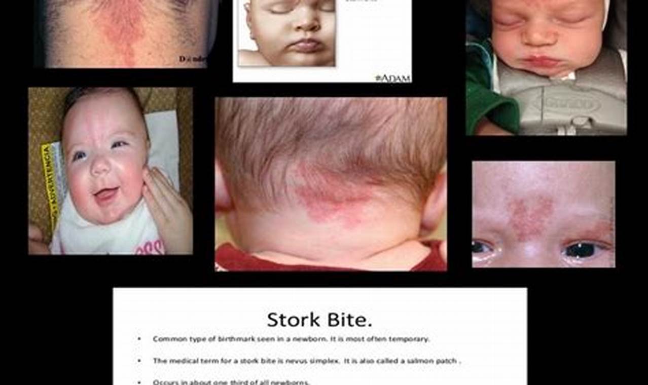 Early MTHFR Signs: Gene Mutation Clues in Babies Baby Care 101: Essential Tips for Happy, Healthy Babies Early MTHFR Signs: Gene Mutation Clues in Babies | Baby Care 101: Essential Tips for Happy, Healthy Babies