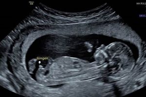 A Quick Baby Glimpse: Moments & Milestones for Babies | Baby Care 101: Essential Tips for Happy, Healthy Babies