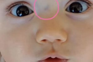 Baby's Blue Vein Nose: Causes, Care, & When to Worry | Baby Care 101: Essential Tips for Happy, Healthy Babies
