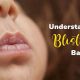 Is It Serious? Baby Lip Blister Guide &amp; Care | Baby Care 101: Essential Tips for Happy, Healthy Babies