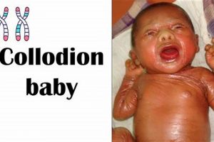 What is Collodion Baby? Causes, Symptoms & Care | Baby Care 101: Essential Tips for Happy, Healthy Babies