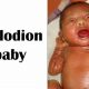 What is Collodion Baby? Causes, Symptoms & Care | Baby Care 101: Essential Tips for Happy, Healthy Babies