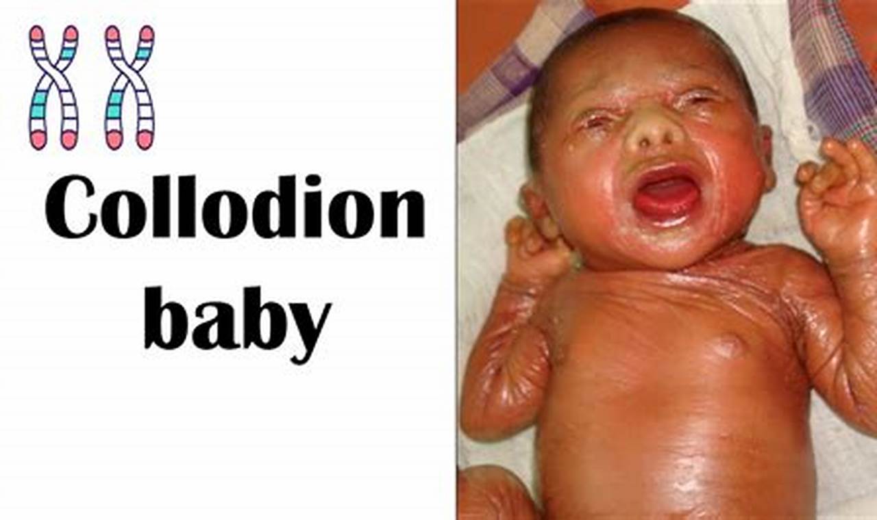 What is Collodion Baby? Causes, Symptoms & Care | Baby Care 101: Essential Tips for Happy, Healthy Babies