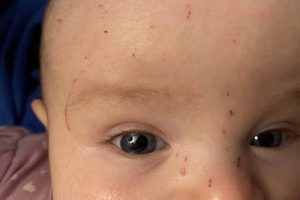 Stop Baby Scratching Face: Causes & Solutions Baby Care 101: Essential Tips for Happy, Healthy Babies Stop Baby Scratching Face: Causes & Solutions | Baby Care 101: Essential Tips for Happy, Healthy Babies