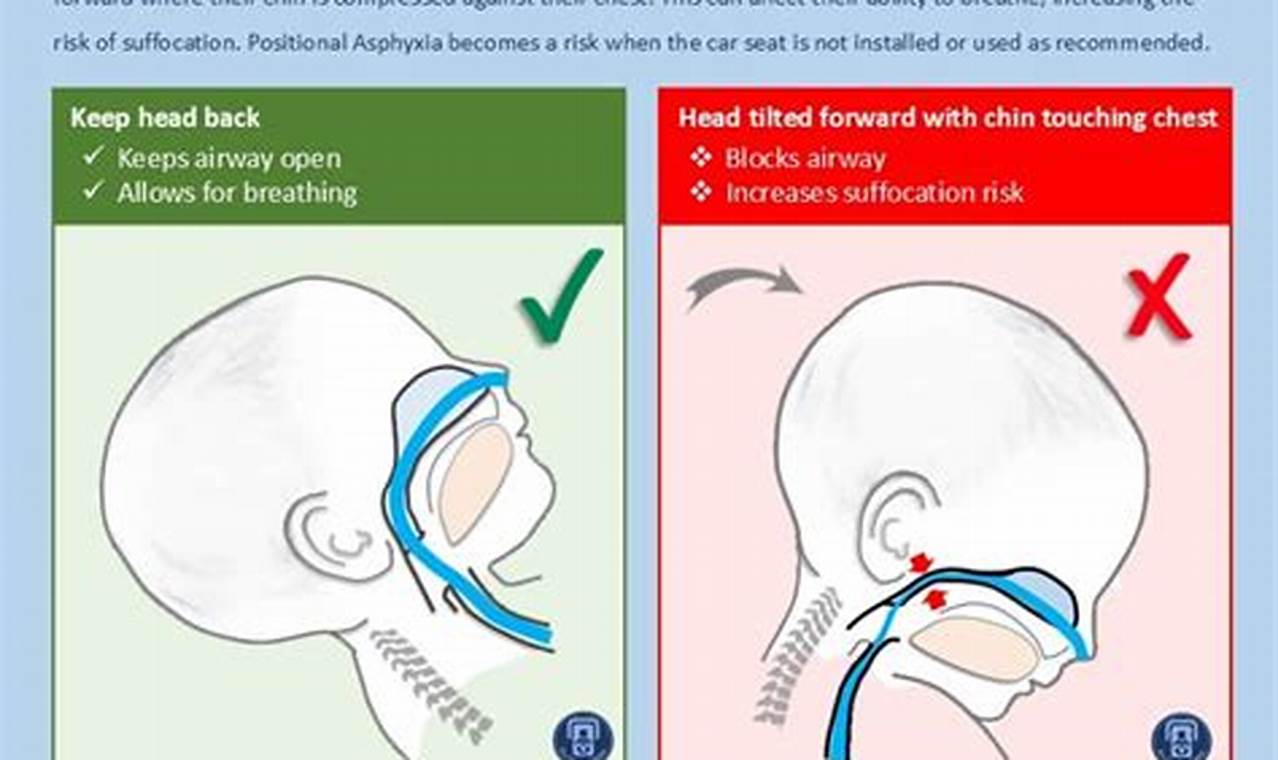 Positional Asphyxiation Baby: Safe Sleep Tips for Infants | Baby Care 101: Essential Tips for Happy, Healthy Babies