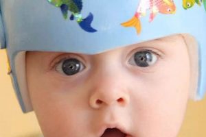 Baby Helmet Time: How Long Do Babies Wear Helmets For? | Baby Care 101: Essential Tips for Happy, Healthy Babies