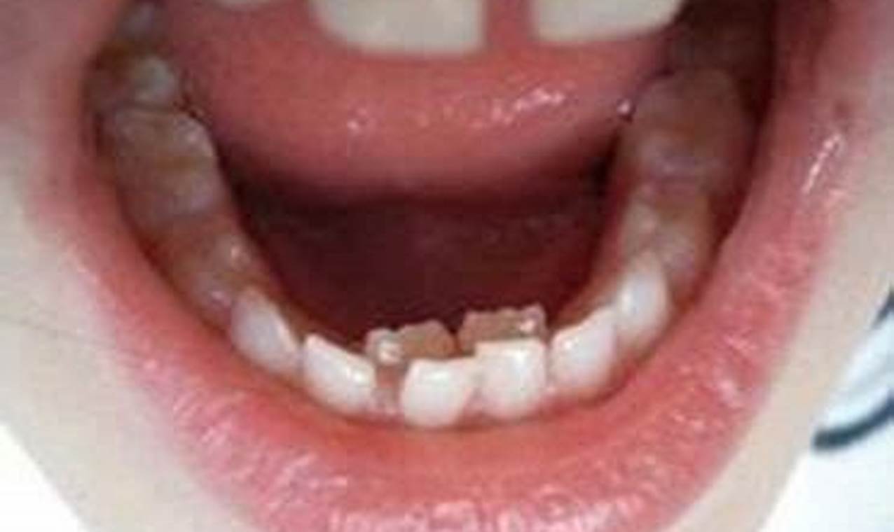 Help! Adult Tooth Behind Baby Tooth [Causes & Fixes] | Baby Care 101: Essential Tips for Happy, Healthy Babies