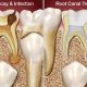 Baby Root Canal Guide: Is It Right For Your Little One? | Baby Care 101: Essential Tips for Happy, Healthy Babies