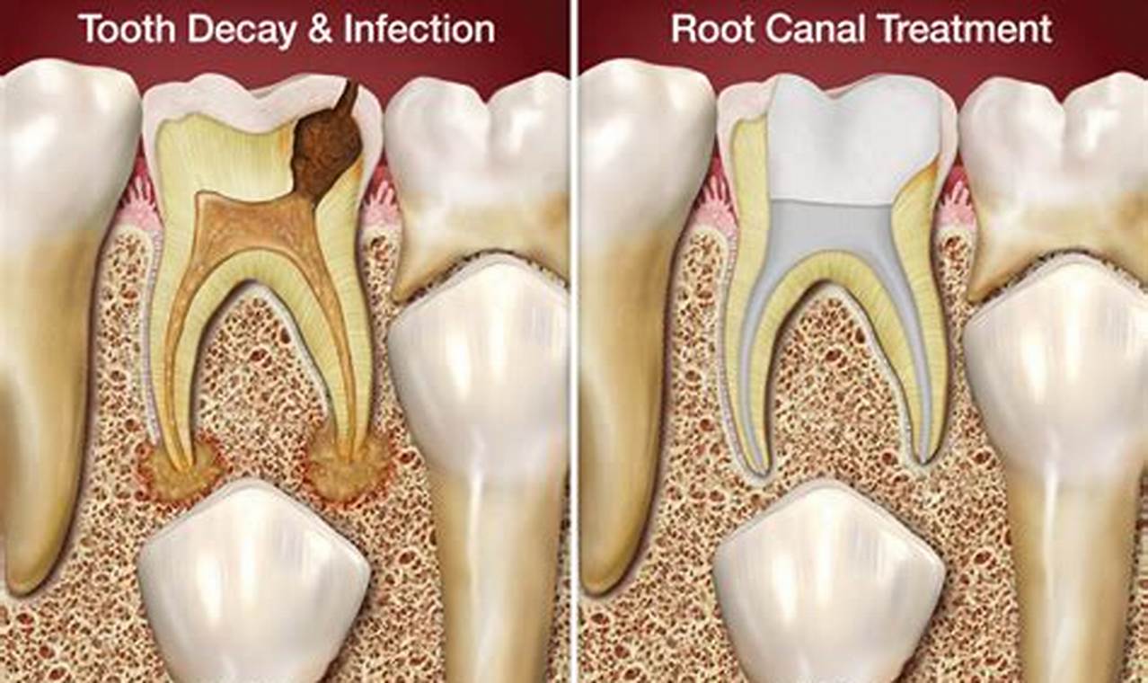 Baby Root Canal Guide: Is It Right For Your Little One? Baby Care 101: Essential Tips for Happy, Healthy Babies Baby Root Canal Guide: Is It Right For Your Little One? | Baby Care 101: Essential Tips for Happy, Healthy Babies
