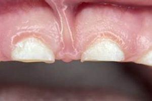 Is Your Baby Grinding Teeth? Causes & Solutions | Baby Care 101: Essential Tips for Happy, Healthy Babies