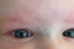 Baby's Blue Vein Between Eyes: Normal or Not? Baby Care 101: Essential Tips for Happy, Healthy Babies Baby's Blue Vein Between Eyes: Normal or Not? | Baby Care 101: Essential Tips for Happy, Healthy Babies