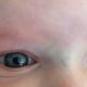 Baby's Blue Vein Between Eyes: Normal or Not? | Baby Care 101: Essential Tips for Happy, Healthy Babies