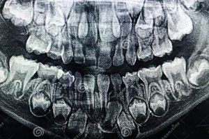 Baby Teeth X-Ray Guide: Care, Safety &amp; More | Baby Care 101: Essential Tips for Happy, Healthy Babies