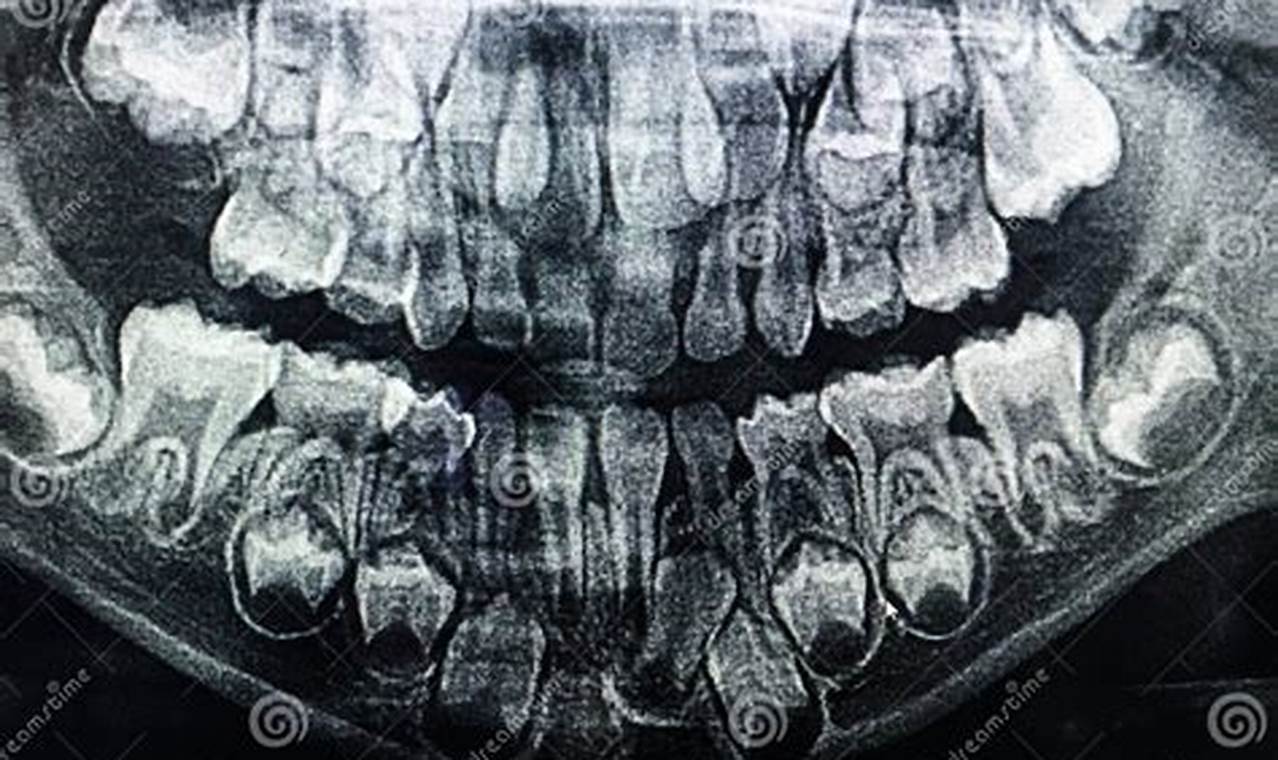 Baby Teeth X-Ray Guide: Care, Safety &amp; More | Baby Care 101: Essential Tips for Happy, Healthy Babies