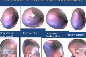 Baby Head Shapes: Abnormal Pics, Causes & Care Tips | Baby Care 101: Essential Tips for Happy, Healthy Babies