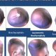 Baby Head Shapes: Abnormal Pics, Causes & Care Tips | Baby Care 101: Essential Tips for Happy, Healthy Babies