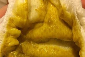 Is Baby's Poop Foamy? Causes & Solutions for Babies! | Baby Care 101: Essential Tips for Happy, Healthy Babies