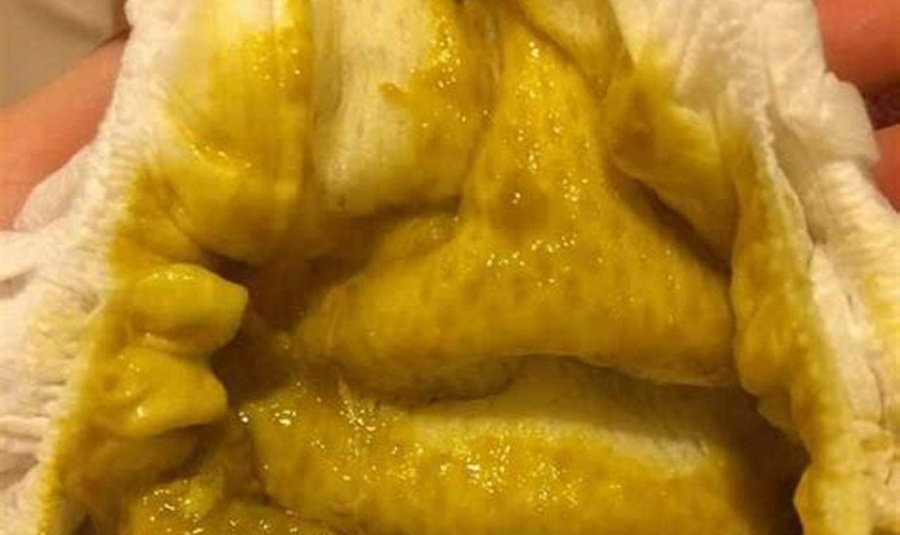 Is Baby's Poop Foamy? Causes & Solutions for Babies! | Baby Care 101: Essential Tips for Happy, Healthy Babies