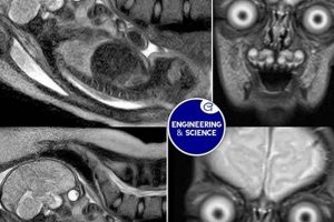 Infant MRI: Safe Scans & What Parents Need to Know | Baby Care 101: Essential Tips for Happy, Healthy Babies