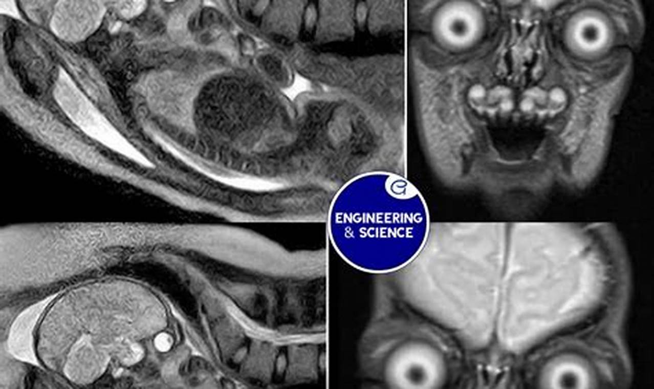 Infant MRI: Safe Scans & What Parents Need to Know | Baby Care 101: Essential Tips for Happy, Healthy Babies