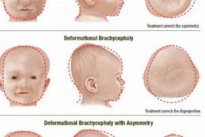 Understanding Baby Head Shape + Tips & Info | Baby Care 101: Essential Tips for Happy, Healthy Babies