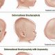 Understanding Baby Head Shape + Tips & Info | Baby Care 101: Essential Tips for Happy, Healthy Babies