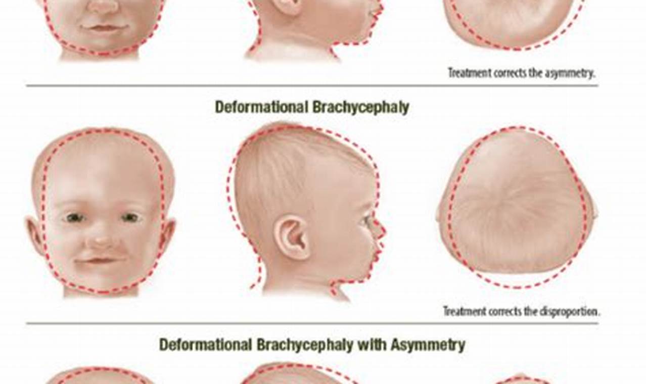 Understanding Baby Head Shape + Tips & Info | Baby Care 101: Essential Tips for Happy, Healthy Babies